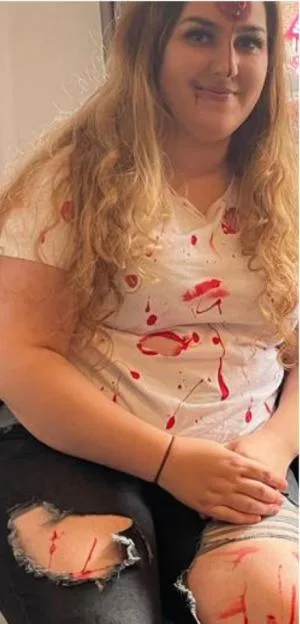 Jess Hulley-Jones in a Halloween costume with fake blood.