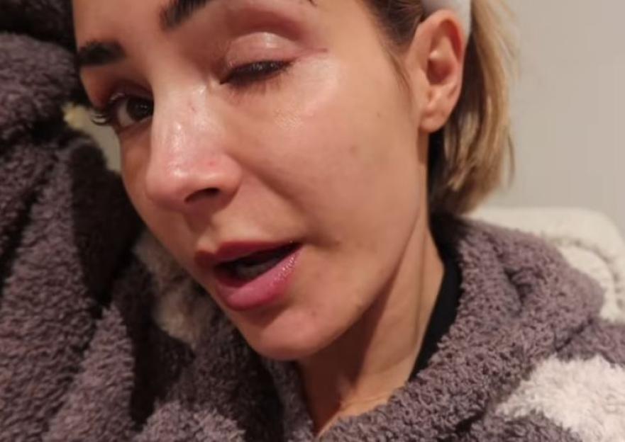 Frankie Bridge Reveals Painful Swollen Face After £1,500 Treatment: 'I'm Really Trying to Look Young!'