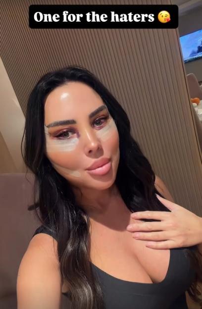 Yazmin Oukhellou with bandages on her face, presumably after cosmetic surgery.
