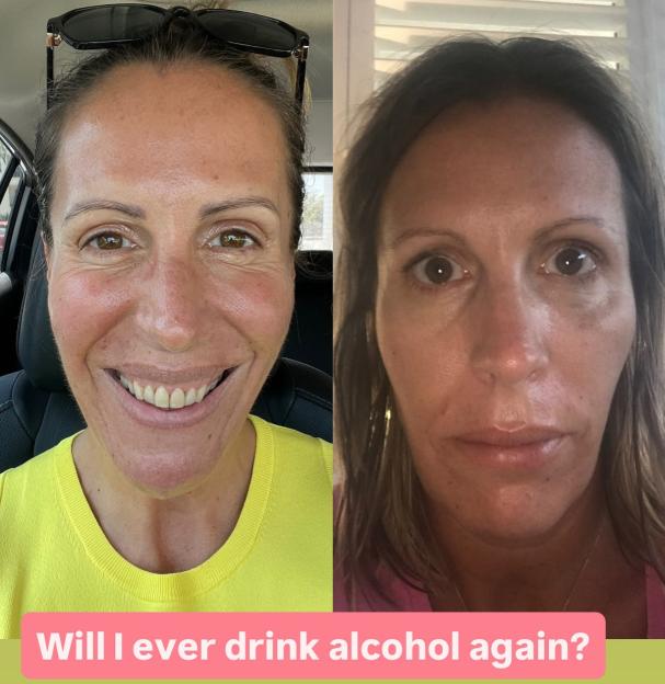 Collage of a woman's face, smiling on the left and with a neutral expression on the right.