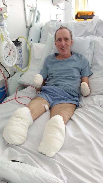 Dad Who Lost Limbs After Christmas Eve Tragedy Can Finally Embrace His Family with Donor Hands