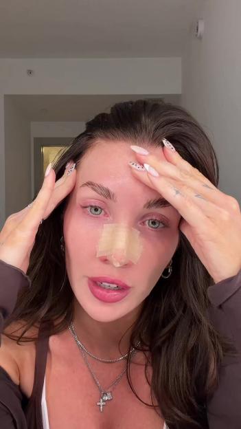 Kate Cassidy with medical tape across her nose and hands on her temples.