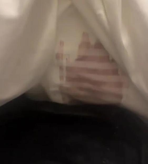 A hospital diaper with a large red bloodstain.