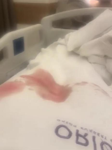 Blood stains on a hospital bedsheet.
