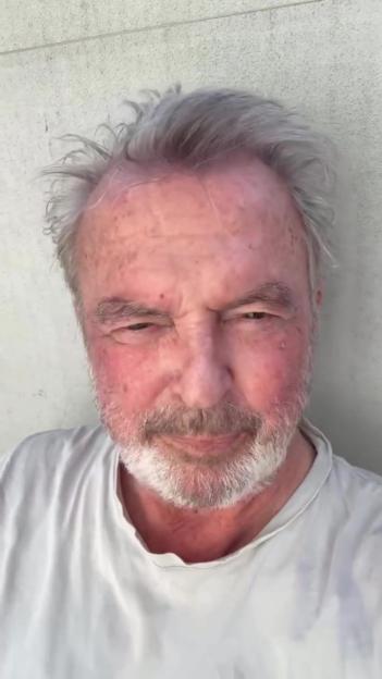 A close-up of a man with grey hair and beard, with red blotches on his face, squinting and grimacing.