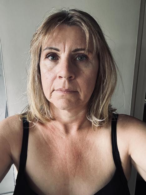 A woman with blonde hair looking directly at the camera, showing a red and wrinkled decolletage.