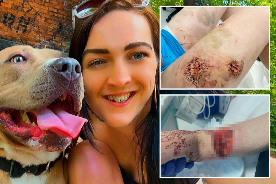 Woman, 32, Suffers Terrifying Injuries After Being Mauled by Dog She Adopted Just Three Weeks Earlier