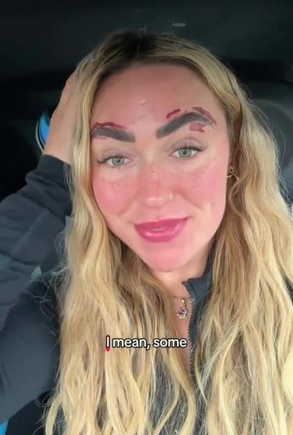 'I Burned My Skin from Eyebrow Waxing: A Common Mistake That Could Affect Thousands of Brits!'