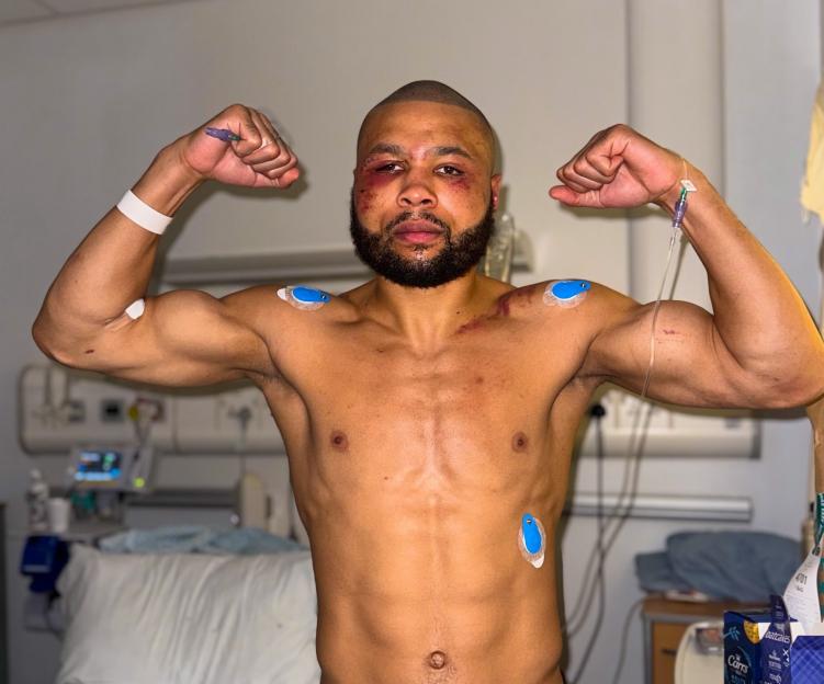 A man in a hospital gown with bruises on his face and body flexes his biceps, showing off his strength.