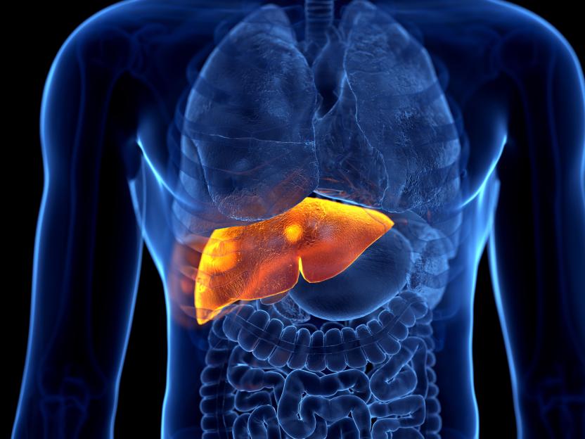 Liver cancer, illustration