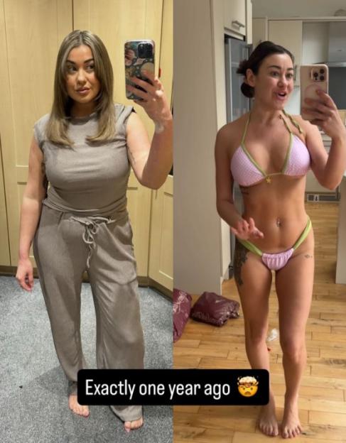 Ibiza Weekender Star Ellie Young Flaunts Stunning One-Year Weight Loss in a Bikini!