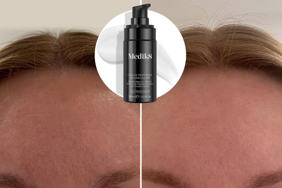 Before and after photos showing wrinkle reduction using Medik8 Liquid Peptides Advanced MP serum.