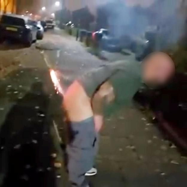 Man Seriously Injured Attempting to Launch Firework from His Rear End on Bonfire Night