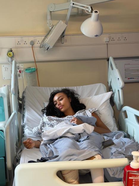 A young woman, Love Island star Ella Thomas, in a hospital bed with bandages on her lower legs.