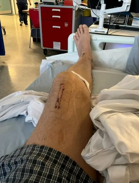 ¿Devastated¿ man learns attacker who nearly killed him could be released early