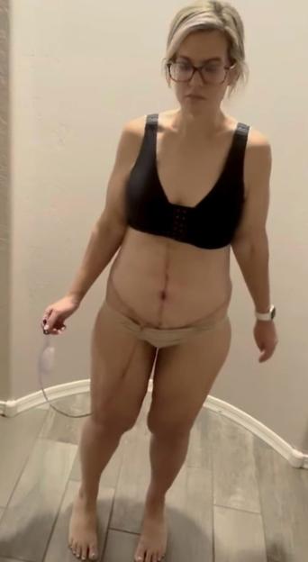 Arizona mom drops 180 lbs with Mounjaro, calls it 'life-changing'