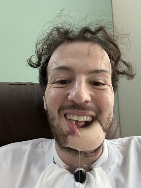 Andr Gayoso after his jaw was reconstructed.