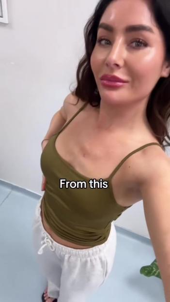 'MAFS Bride Sparks Debate with Stunning New Boob Job After Turkish Surgery Adventure'