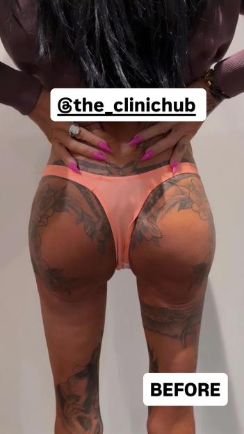 Katie Price Flaunts Her £2k Bum Lift Ahead of Dream Honeymoon with New Husband Lee Andrews!