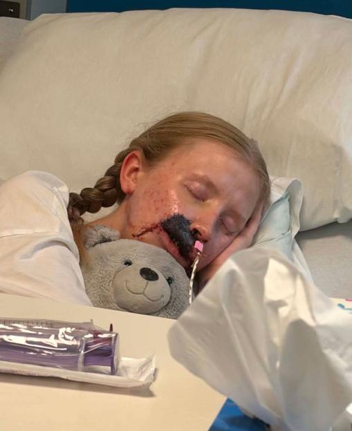 A dog Id known for years ripped my face apart in seconds  I just want to look normal again