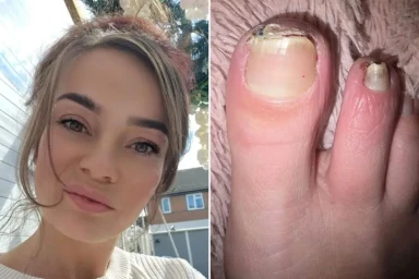 Mum-of-two, 40, has leg amputated after doctors diagnosed her rare disease as ‘anxiety’
