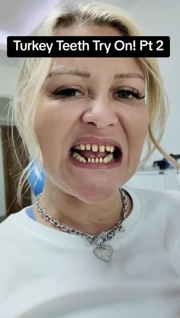 Im like Frankensteins bride after having FULL BODY makeover  even my eyelids and vagina have been transformed