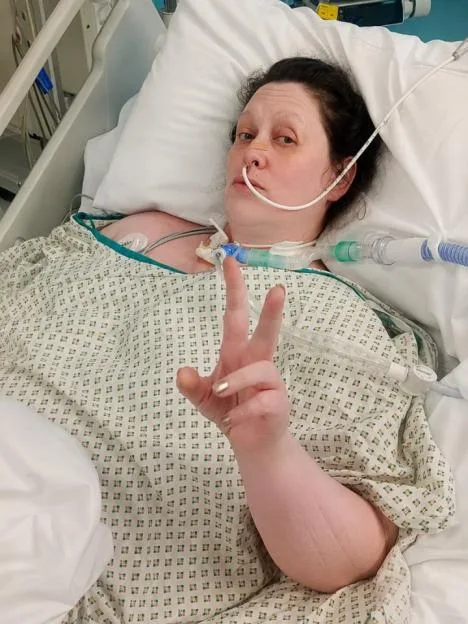 Woman's bowel explodes after 50 pieces of faecal matter became lodged in stomach