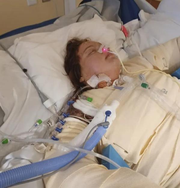 Woman in a hospital bed with medical tubes and bandages.