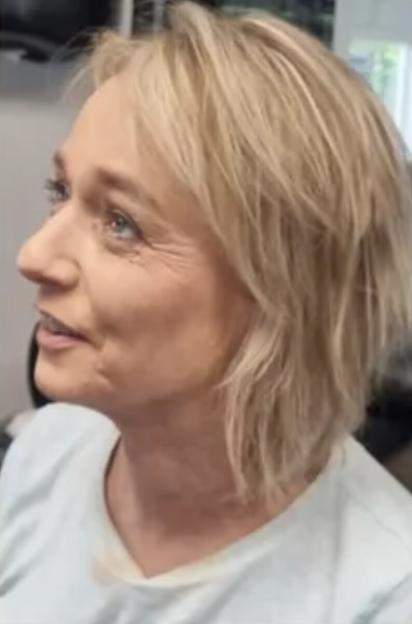 A woman with short blonde hair looks left, her neck and chest are covered in dark, smudged marks.