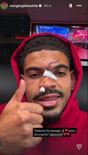Morgan Gibbs-White Displays Shocking Injury: Swollen, Bruised Face Stitched Up After Collision with Sanchez