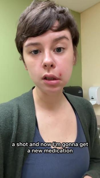 Woman with a pimple on her upper lip, discussing an infection and scarring caused by popping spots.