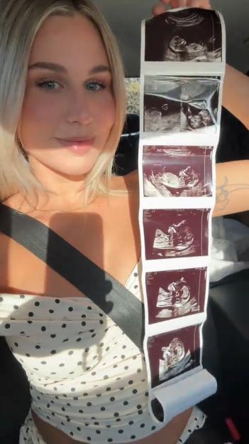 Love Island Alum Announces Exciting News: Expecting First Child Two Years Post-Show!