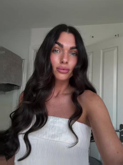 'Sharing My Hair Growth Journey: Facing Trolls Over My 'Biggest Millennial Mistake''