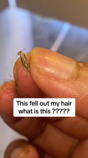 A moth on a person's finger, with loose hair around it.