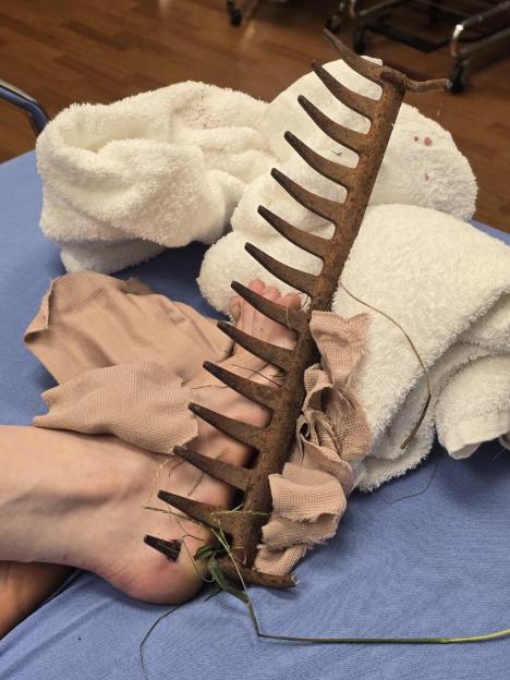 Mum carrying toddler IMPALED by garden rake after being too lazy to put on shoes
