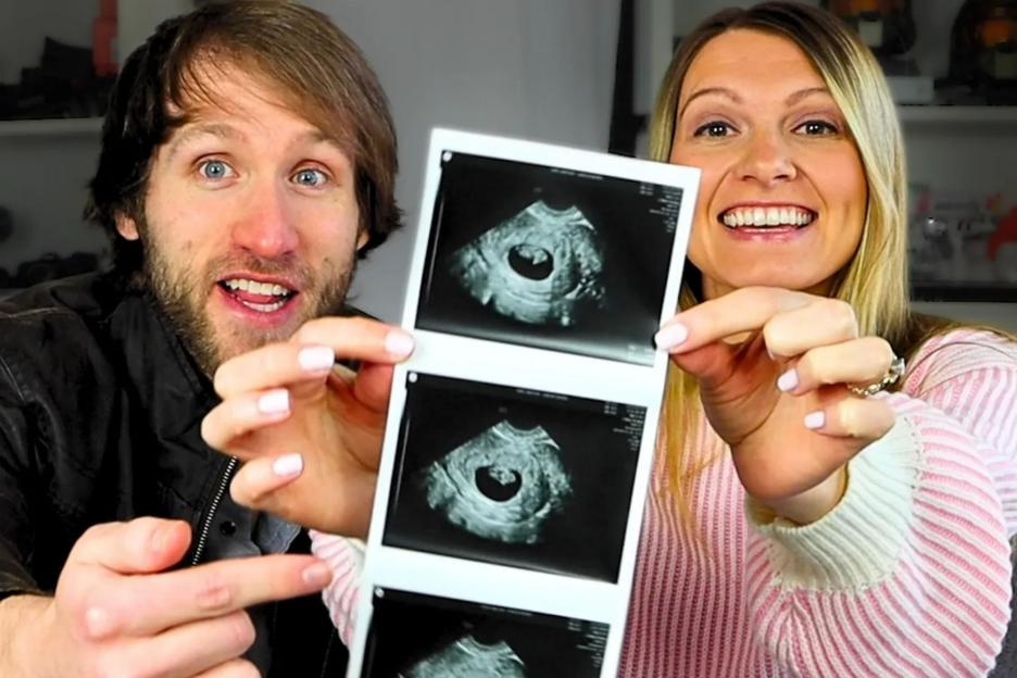 Influencer Couple Shares Heartfelt Decision to End Pregnancy Following Devastating Down Syndrome Diagnosis