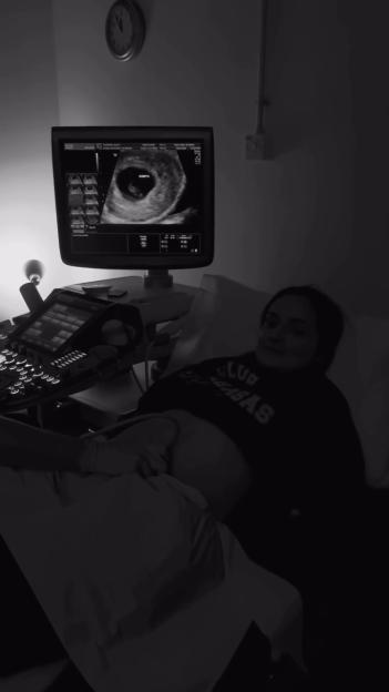 A pregnant woman smiles while receiving an ultrasound; the monitor shows the image of a fetus.