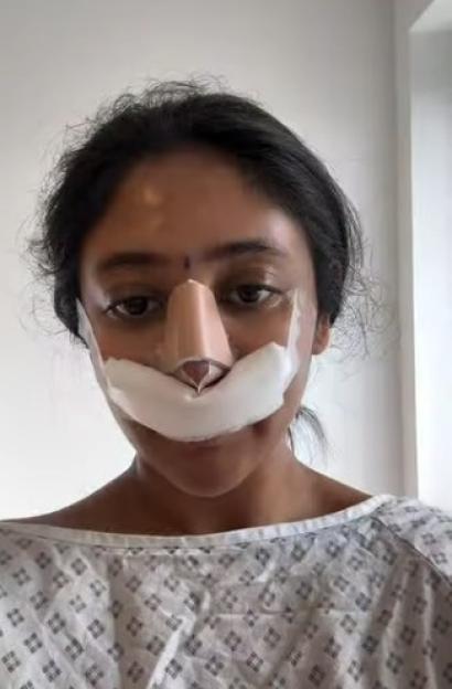 'Married At First Sight Star Shows Off Bandaged Look After Undergoing Nose Job'