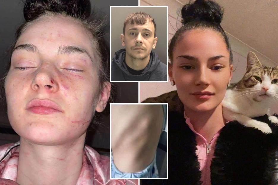 'After Suffering a Broken Rib from My Ex, I'm Heartbroken to Learn He Could Be Released Early Due to Overcrowded Jails'