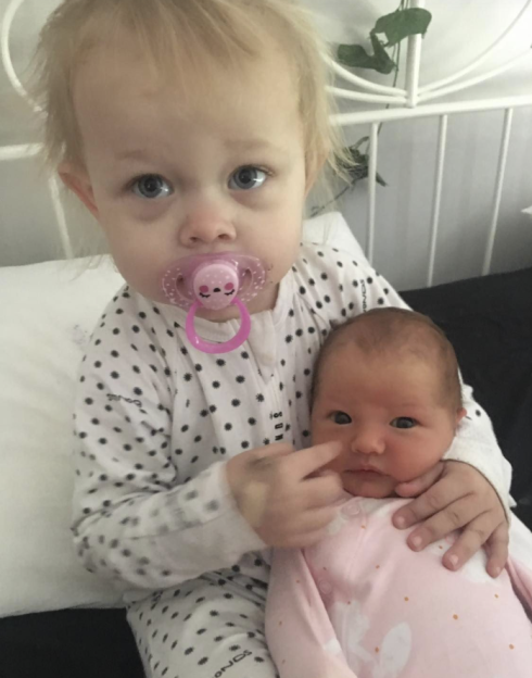 Toddler with pacifier holding newborn baby, whose face has a mark from a burn injury.