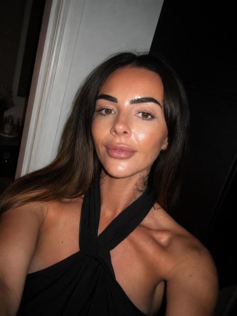 Amy Salmon after her weight loss and cosmetic "tweakments".