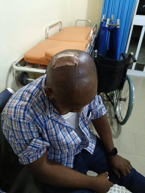 AEDC Officials Seriously Hurt in Abuja Police Quarters During Anti-Electricity Theft Operation