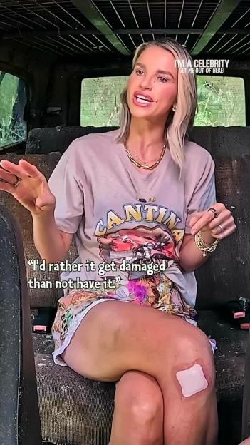 Vogue from I’m A Celeb Finally Addresses Fans’ Speculation About Breaking Show Rules