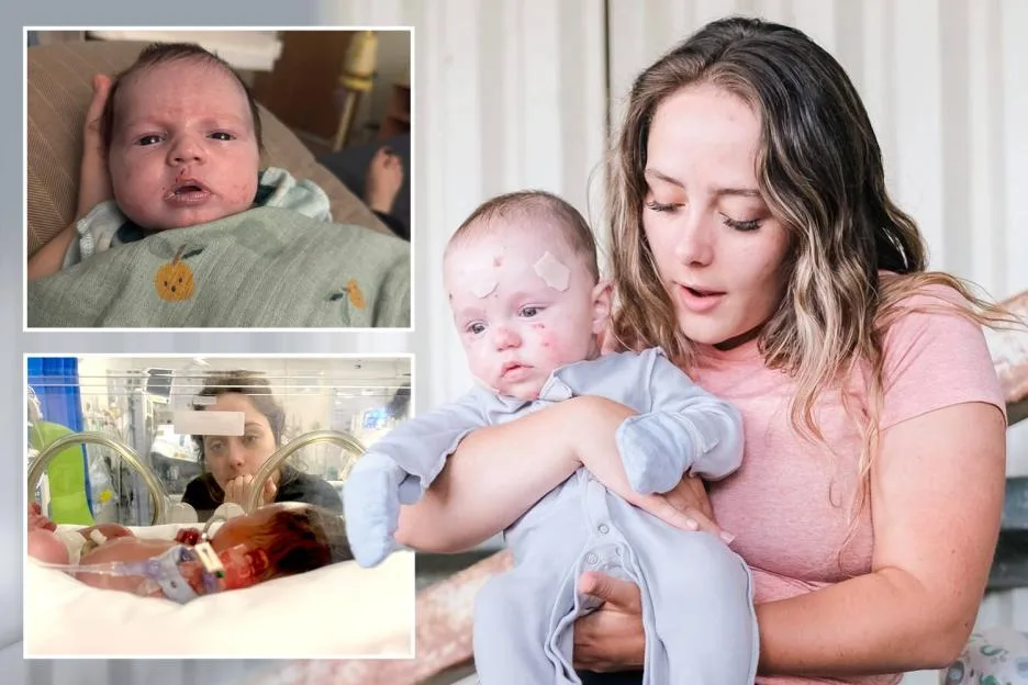 My baby’s skin peeled off in my womb like a glove – I can’t cuddle him & docs can’t cure one in a million condition