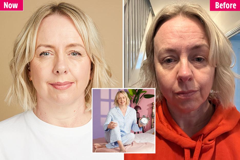 'I’m a Mom Who Slept 10 Hours a Night for a Month—Here’s How It Took 7 Years Off My Face, Saved Me £200, and Boosted My Libido!'