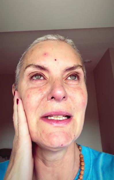 Corrie’s Tracy Shaw Breaks Down After Emergency A&E Visit Due to Severe Chemo Side Effects in Her Breast Cancer Fight