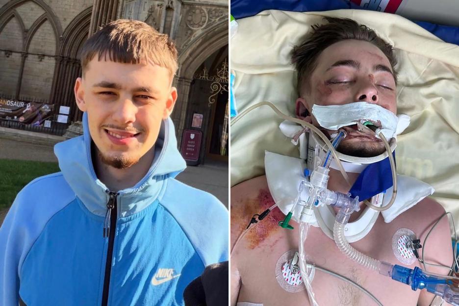 20-Year-Old Brit Ethan Lacey, Critically Injured in Thailand Truck Accident, Removed from Life Support