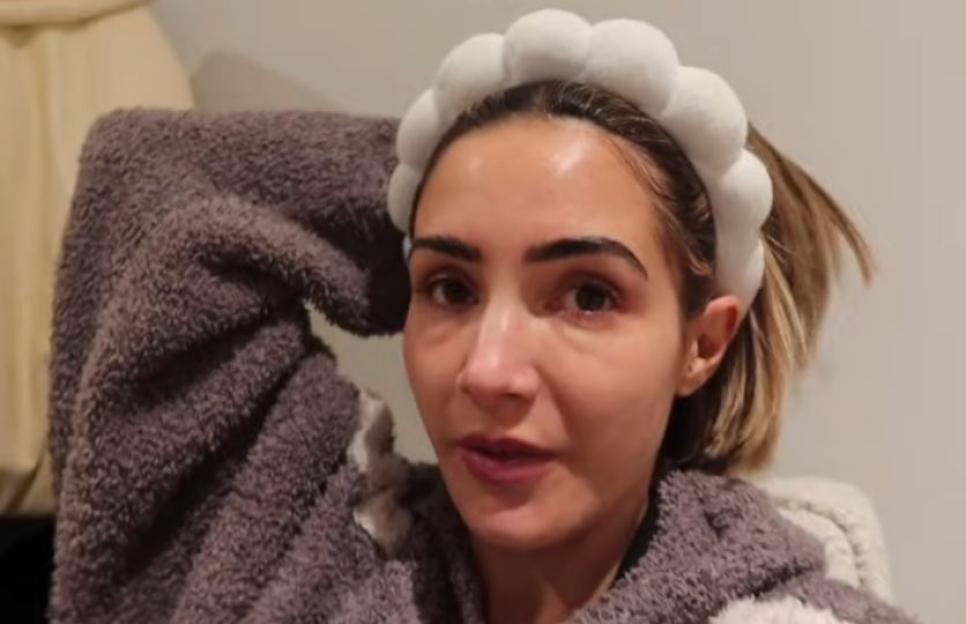 Frankie Bridge with a swollen and bruised face after a cosmetic treatment.