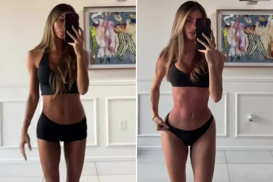 Influencer Pays for Extreme Pain to Achieve Smaller Waist – Experts Caution Against £11k Kardashian-Inspired Procedure