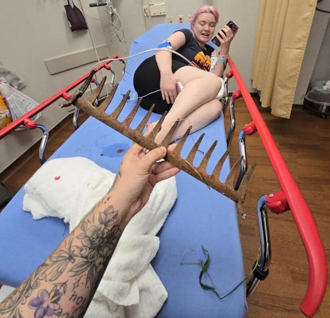 Mum carrying toddler IMPALED by garden rake after being too lazy to put on shoes